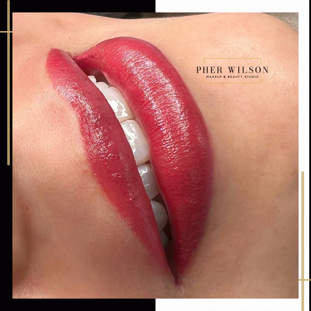 Microlips resultado en fresco